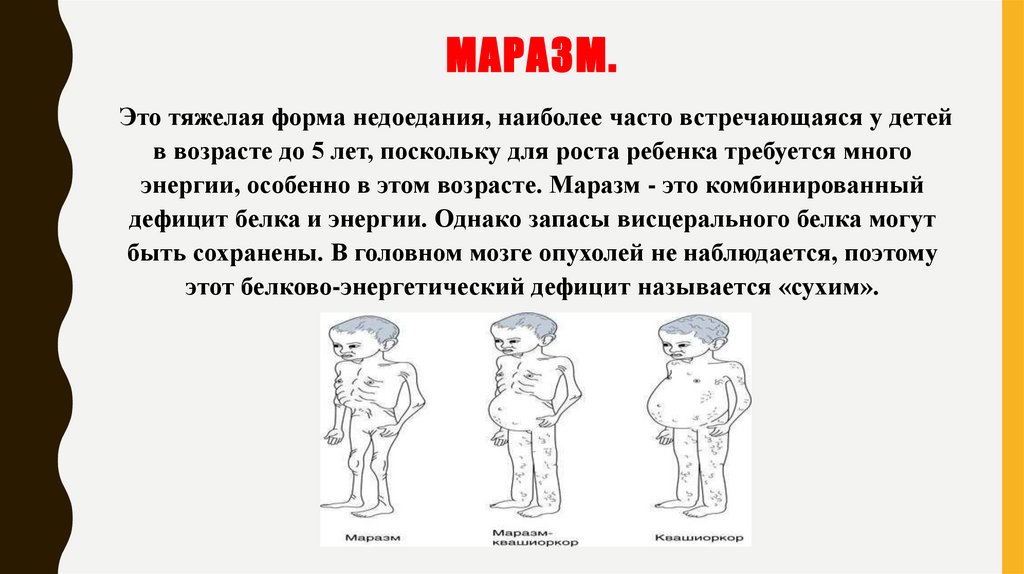 Маразм.