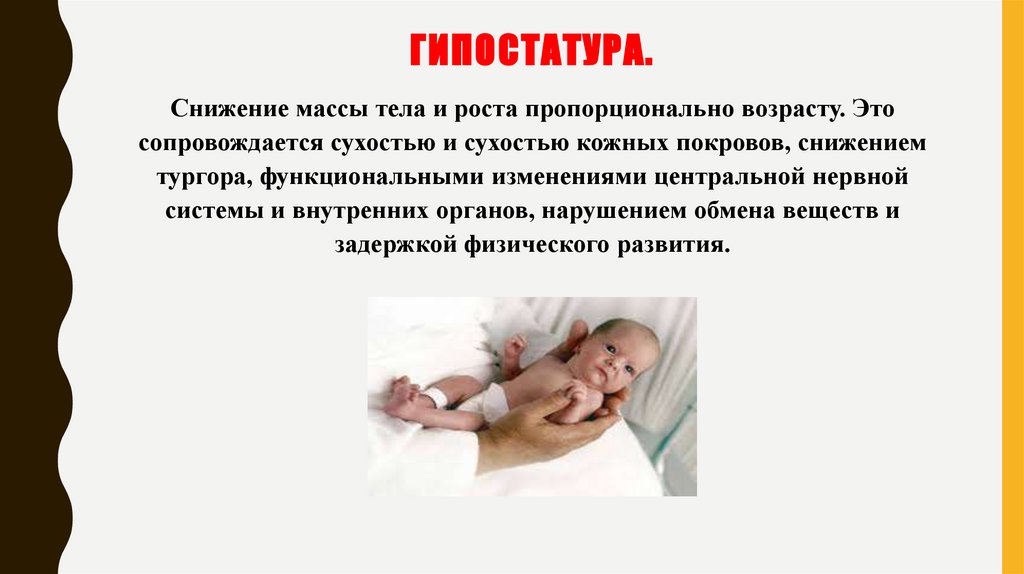 Гипостатура.