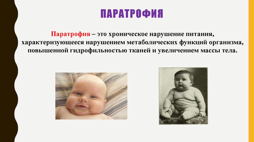 Паратрофия