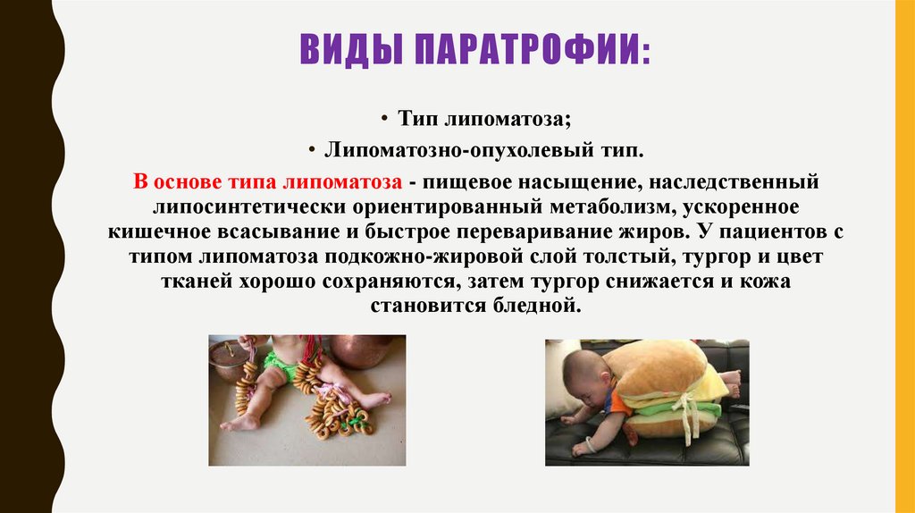 Виды паратрофии: