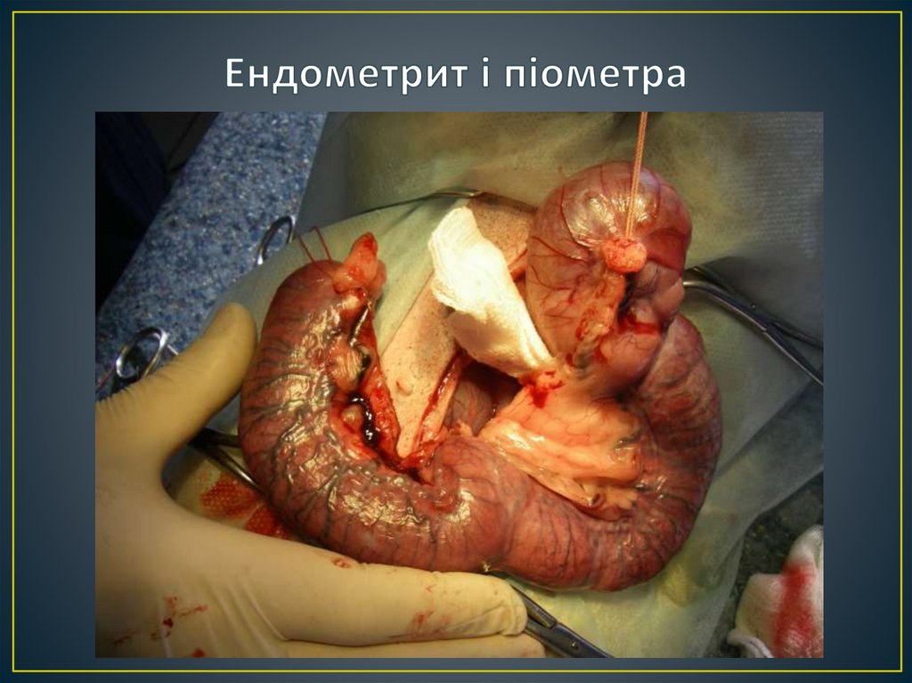 Ендометрит і піометра