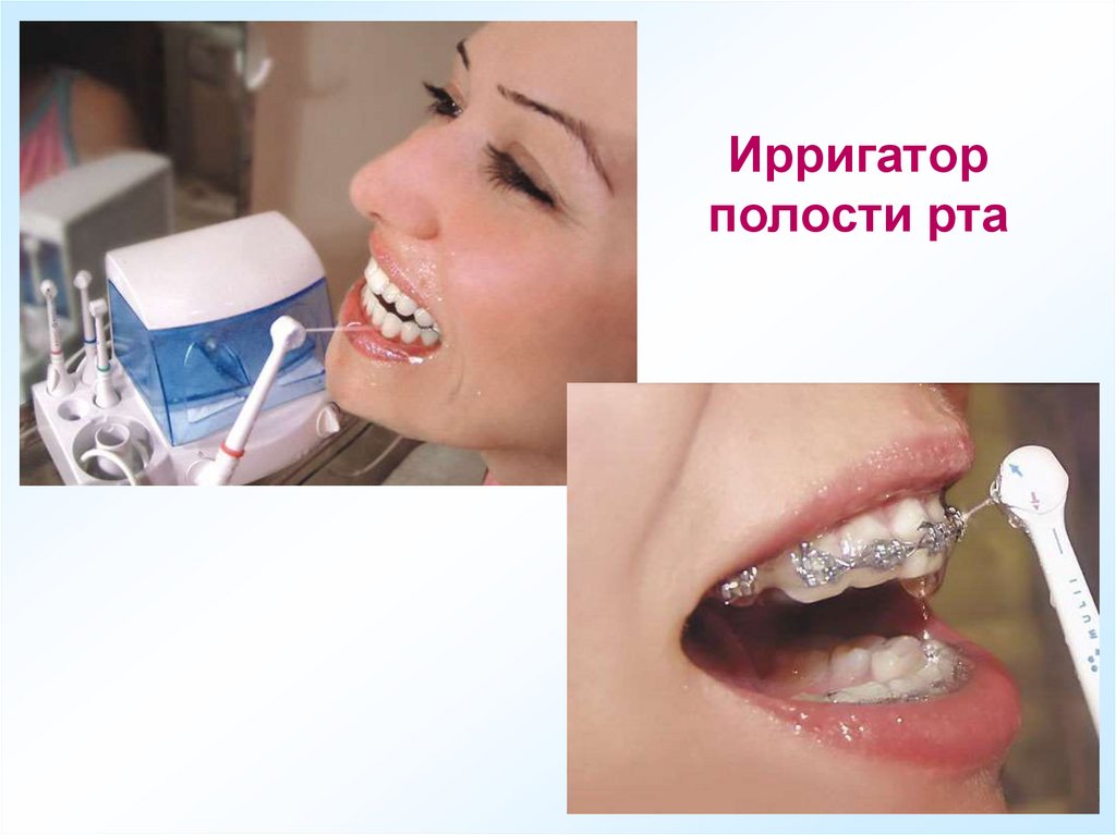 Ирригатор полости рта
