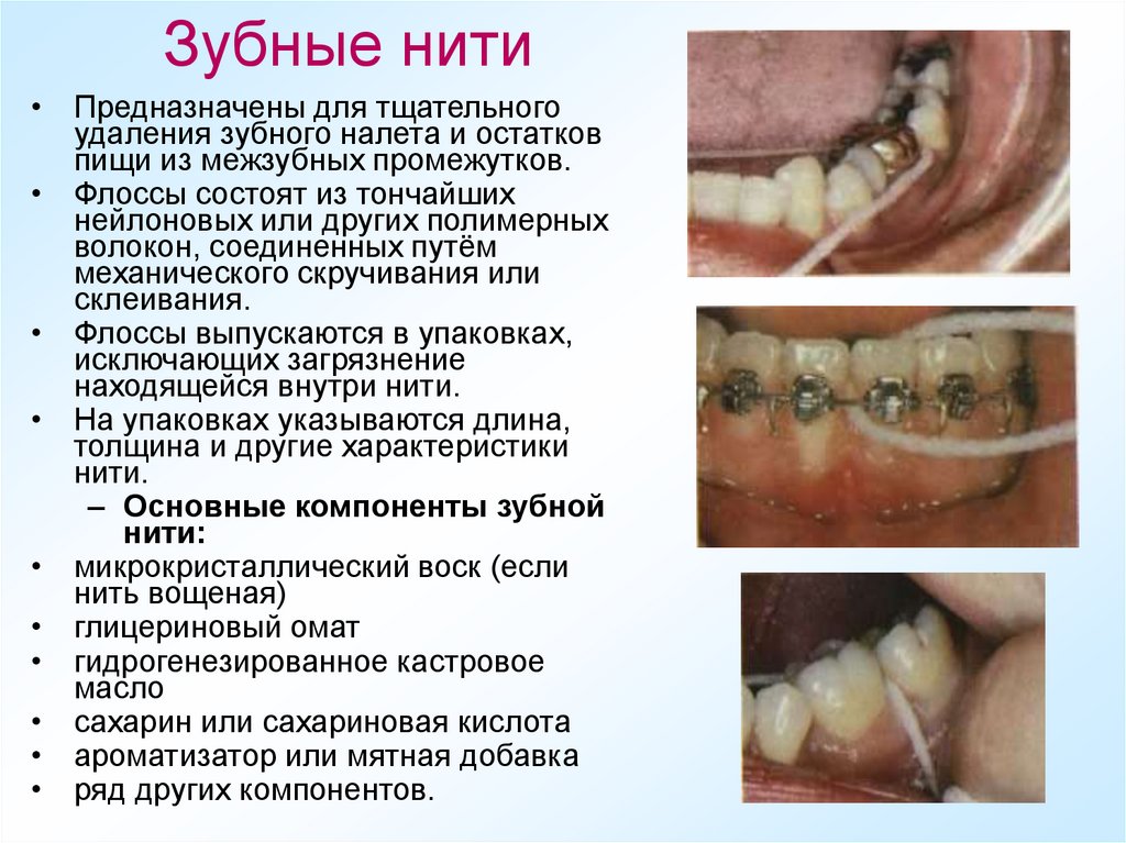 Зубные нити