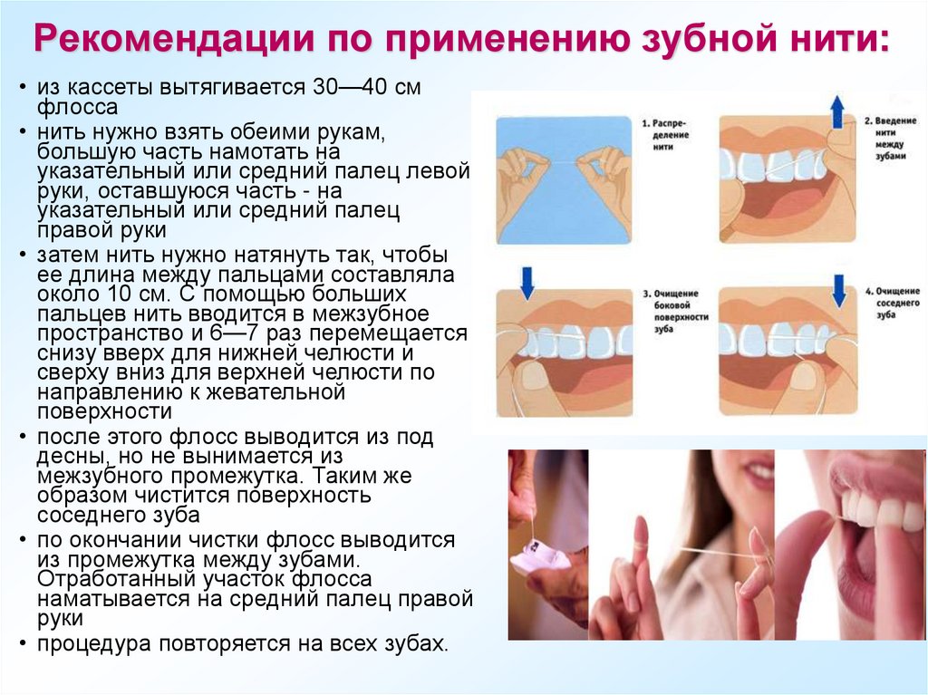 Рекомендации по применению зубной нити: