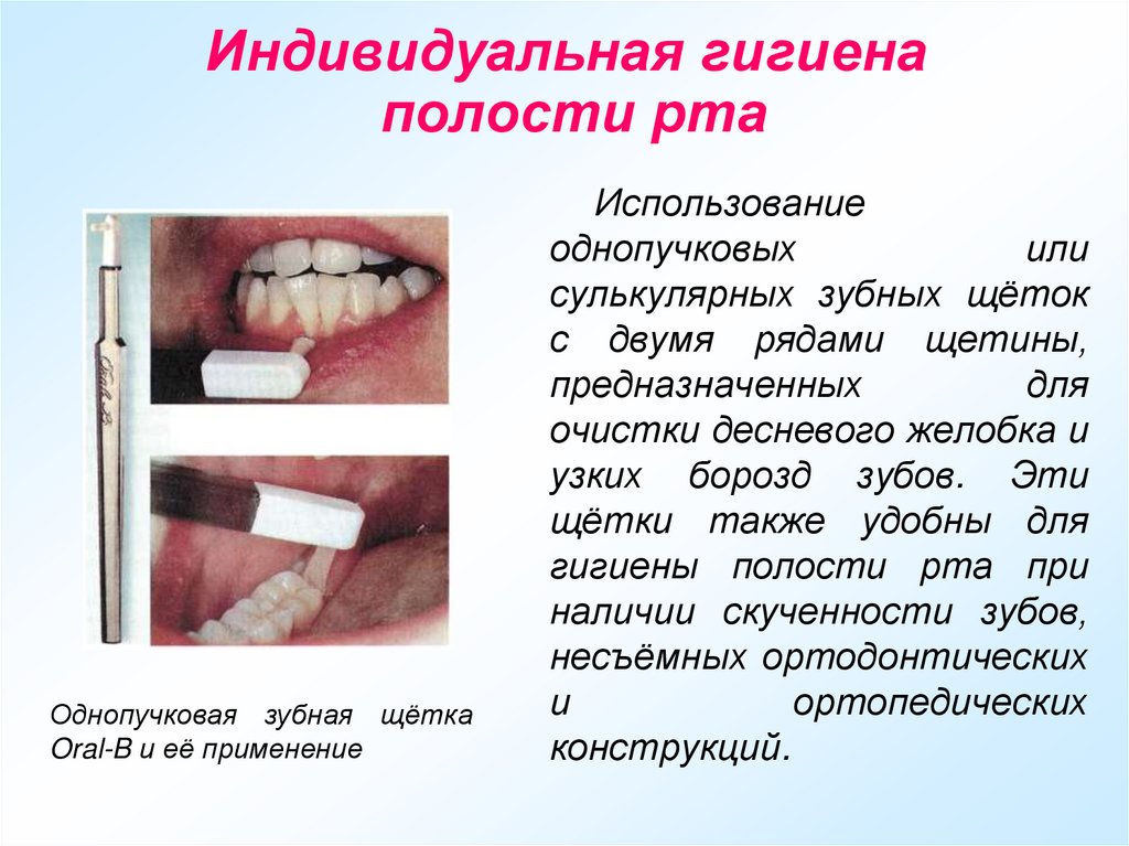 Индивидуальная гигиена полости рта
