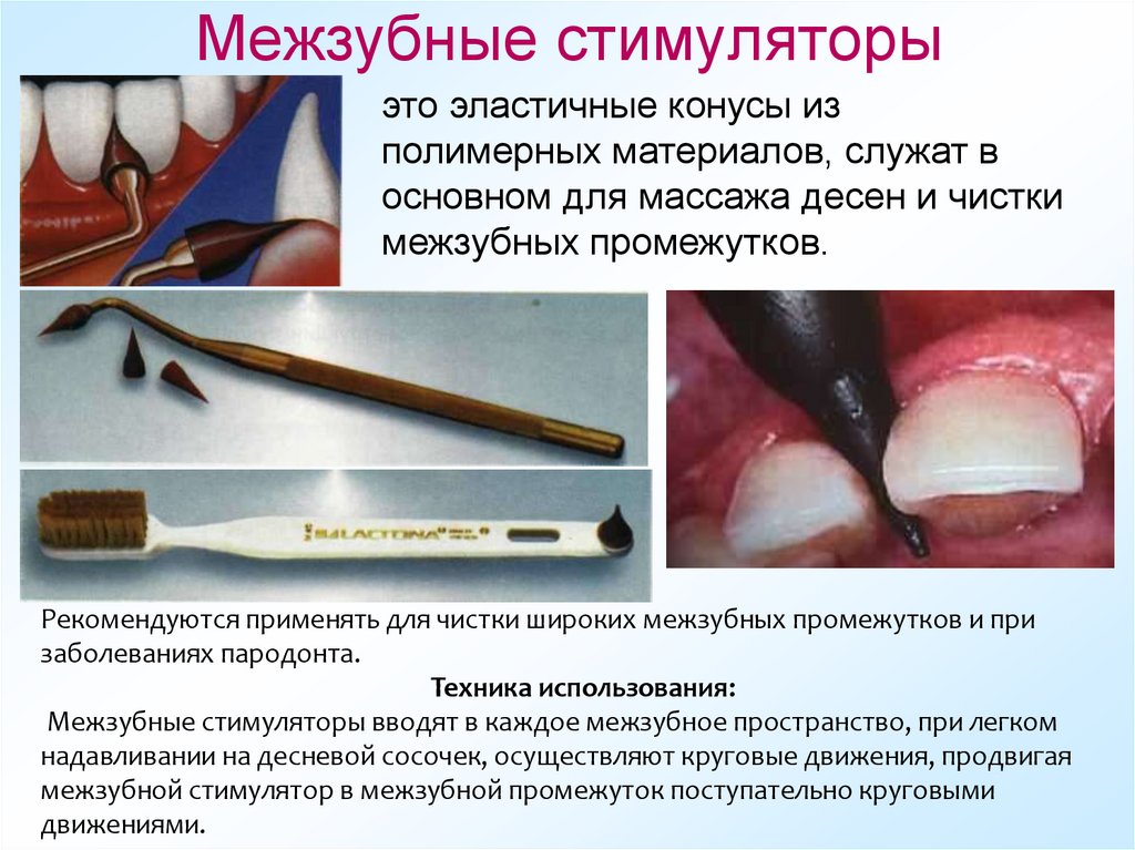 Межзубные стимуляторы