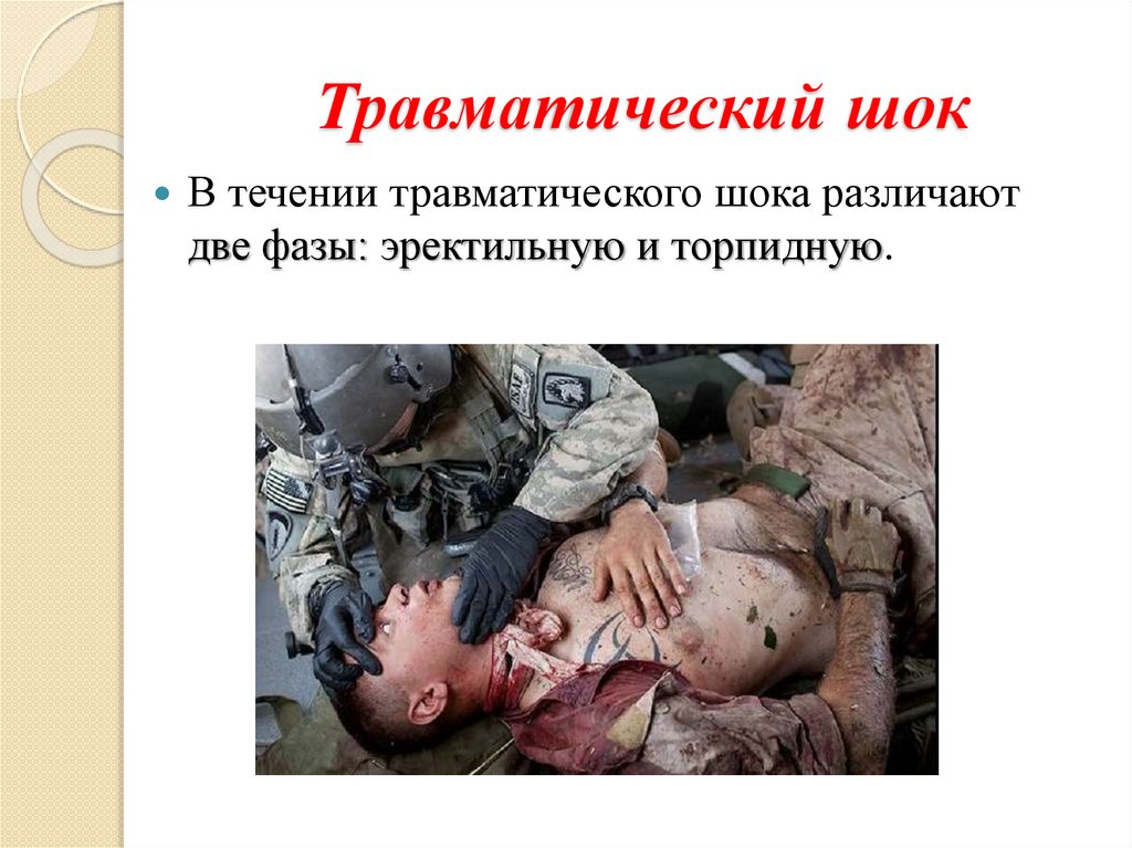 Травматический шок