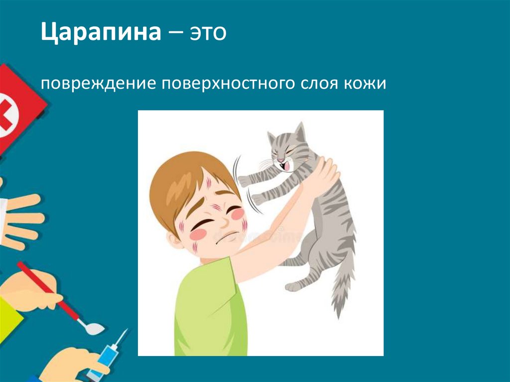 Царапина – это