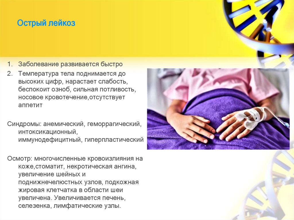 Острый лейкоз