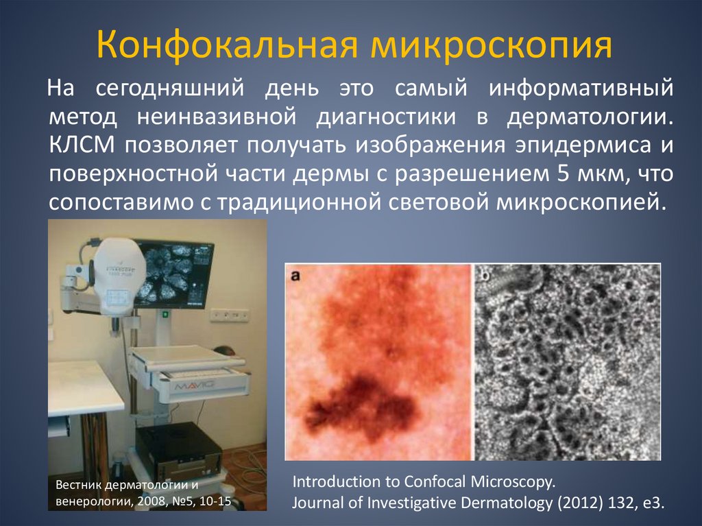 Конфокальная микроскопия