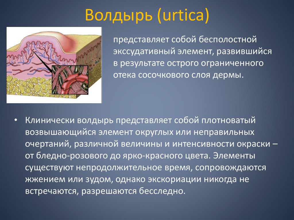 Волдырь (urtica)