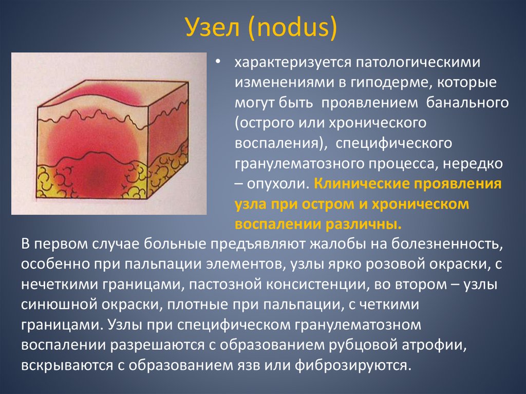Узел (nodus)