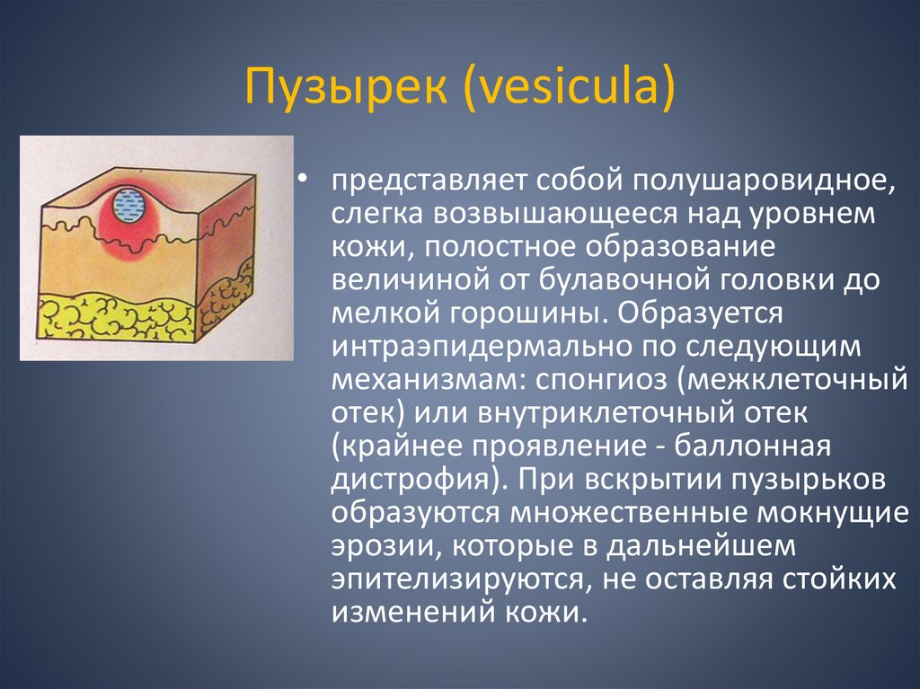 Пузырек (vesicula)