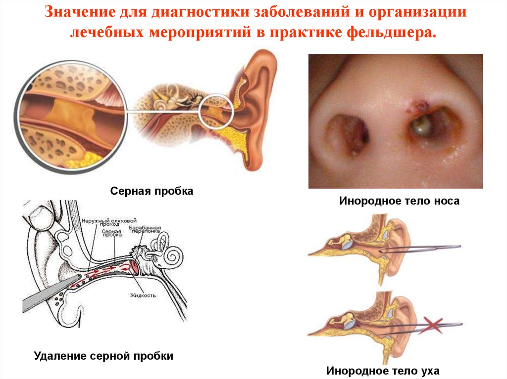 Значение для диагностики заболеваний и организации лечебных мероприятий в практике фельдшера.