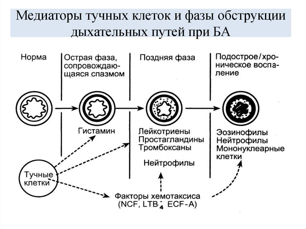 Медиаторы тучных клеток и фазы обструкции дыхательных путей при БА