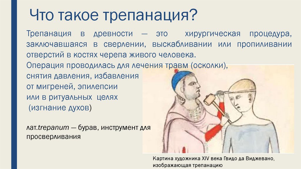 Что такое трепанация?