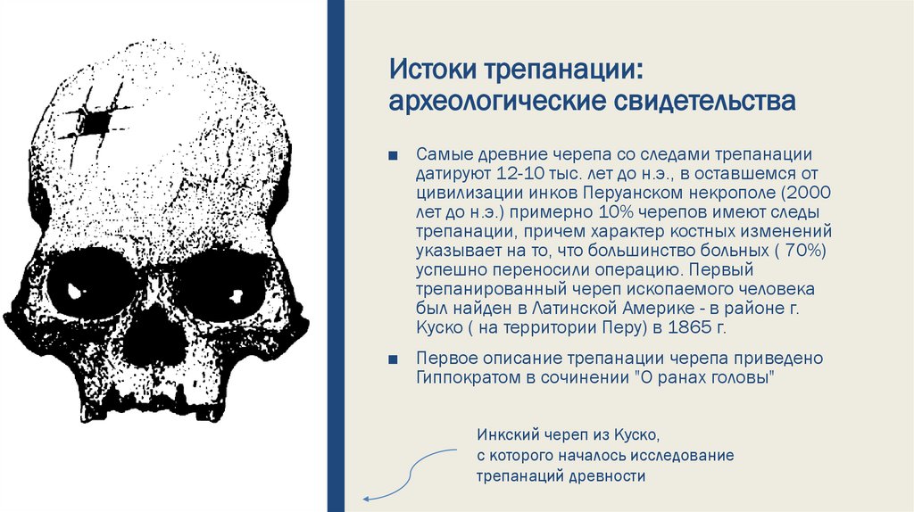 Истоки трепанации: археологические свидетельства