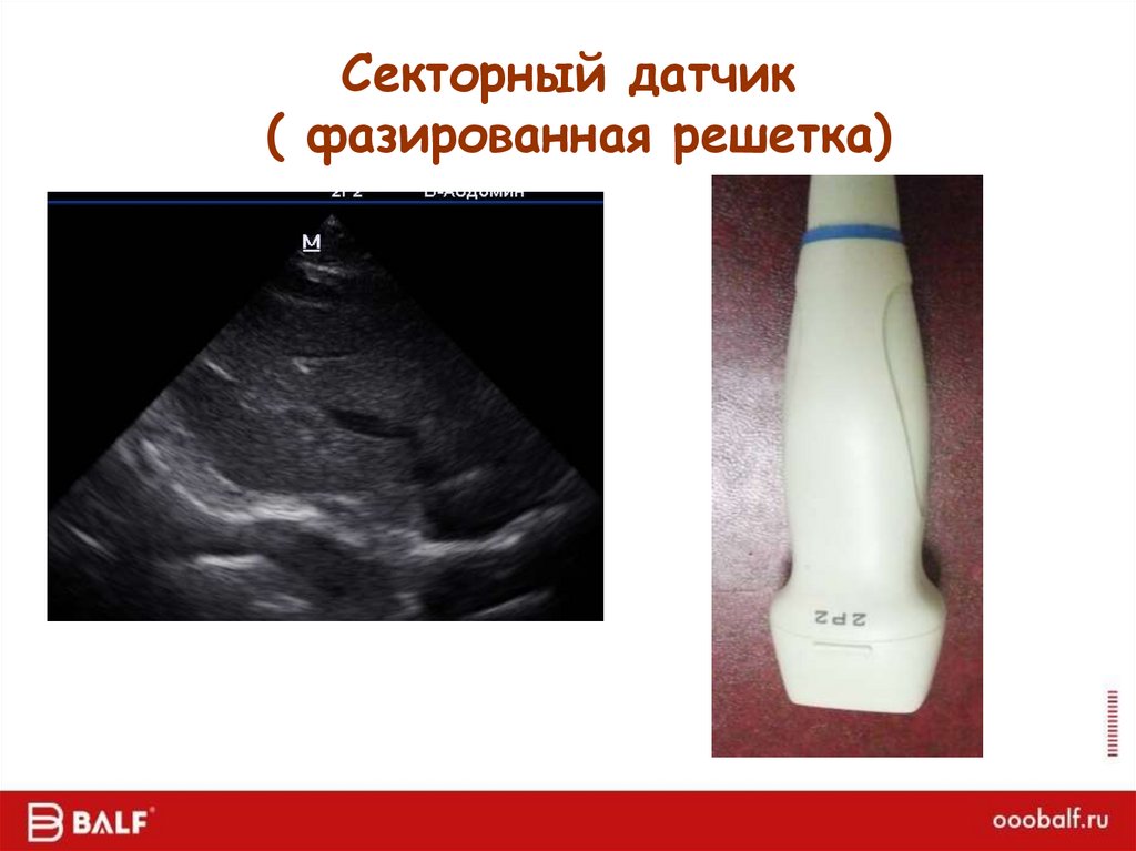 Секторный датчик ( фазированная решетка)