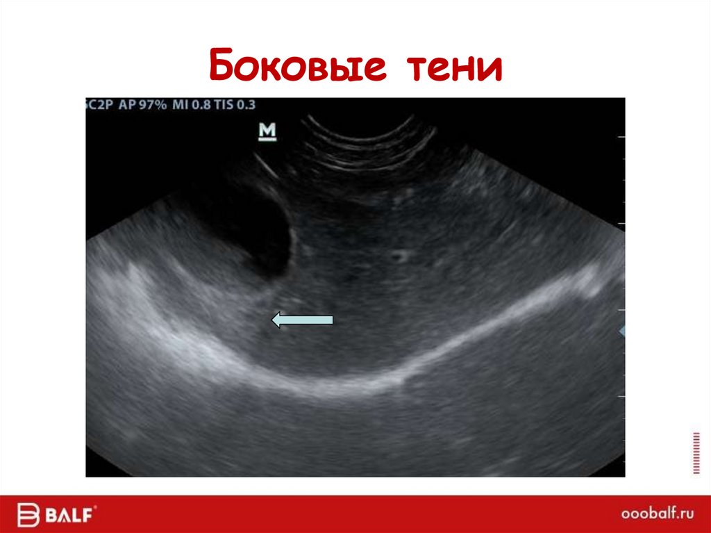 Боковые тени