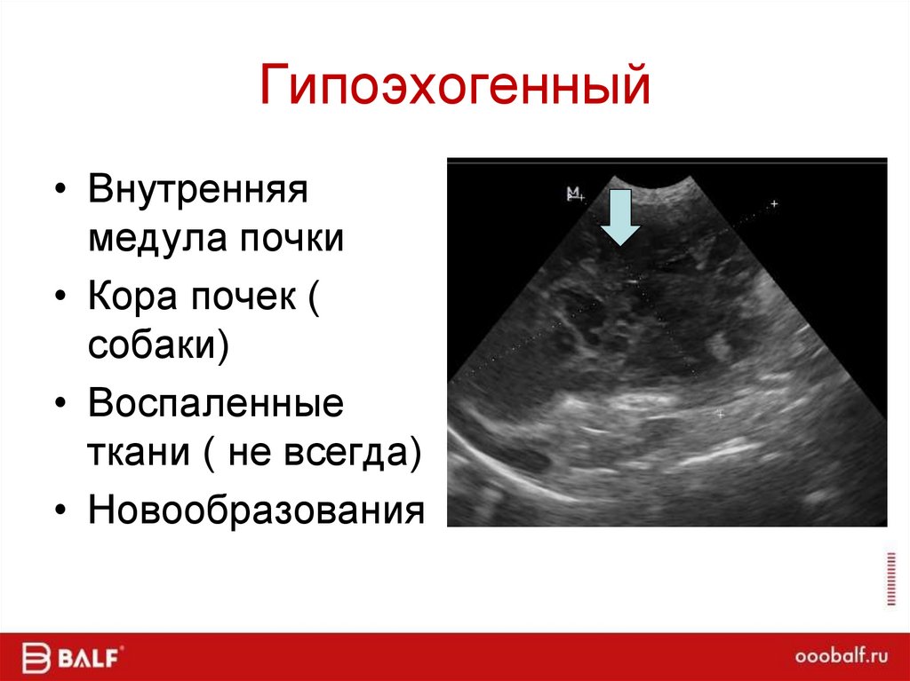 Гипоэхогенный