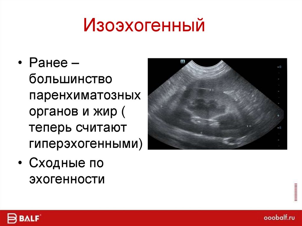Изоэхогенный