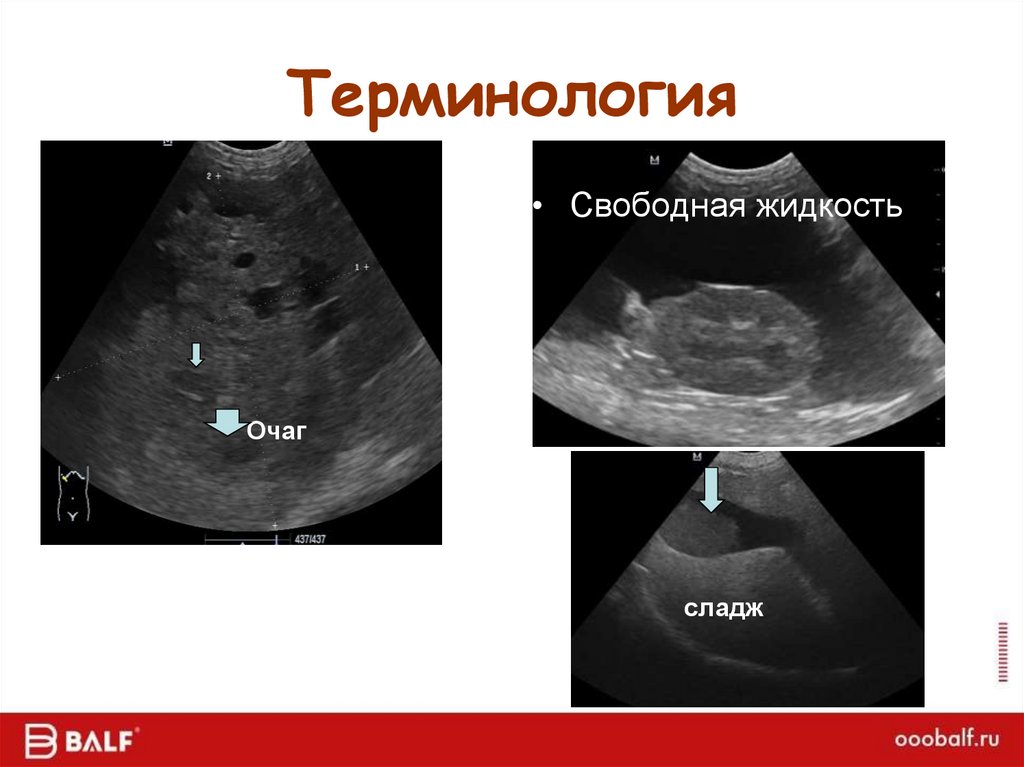 Терминология