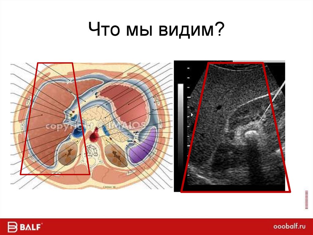Что мы видим?