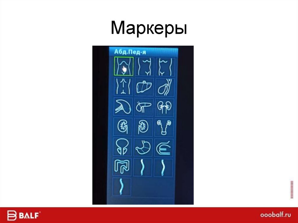 Маркеры