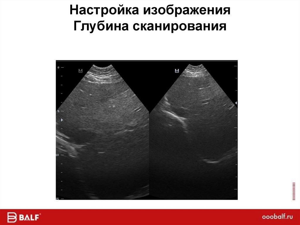 Настройка изображения Глубина сканирования