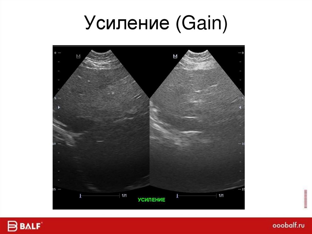 Усиление (Gain)