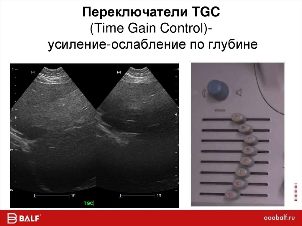 Переключатели TGC (Time Gain Control)- усиление-ослабление по глубине