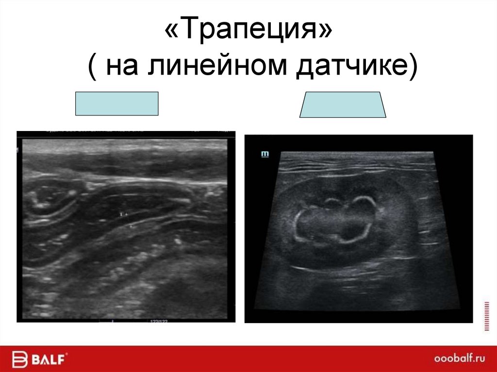 Ширина луча ( FOV,ExFOV)