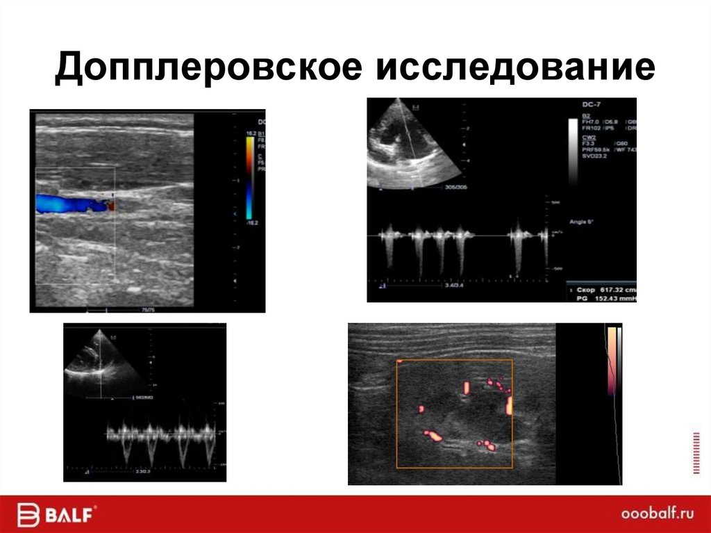 Допплеровское исследование
