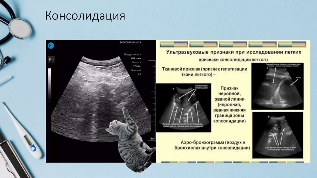 Консолидация