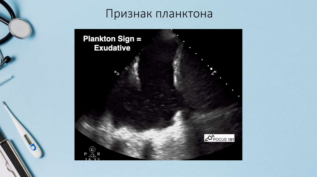 Признак планктона