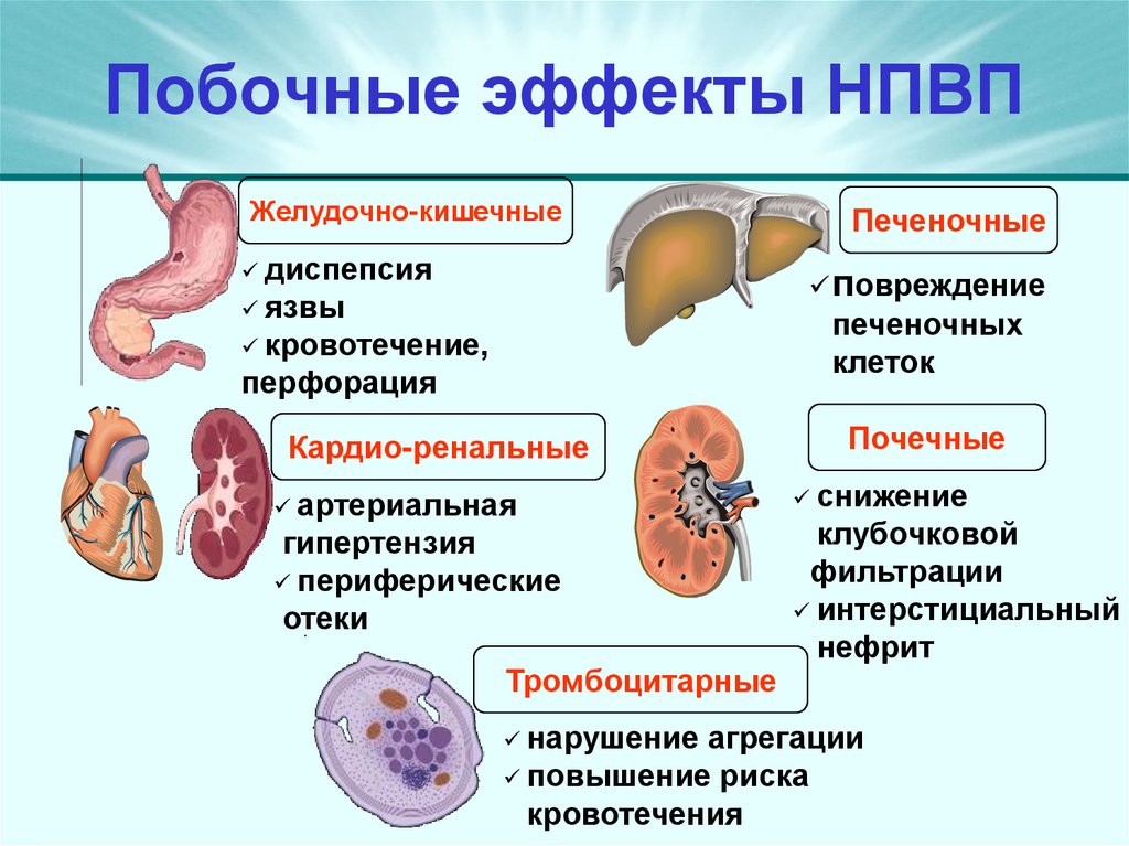 Побочные эффекты НПВП