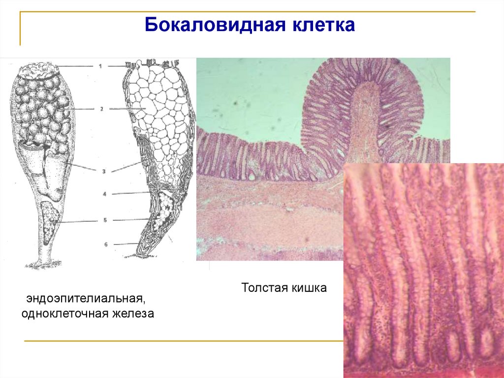 Бокаловидная клетка