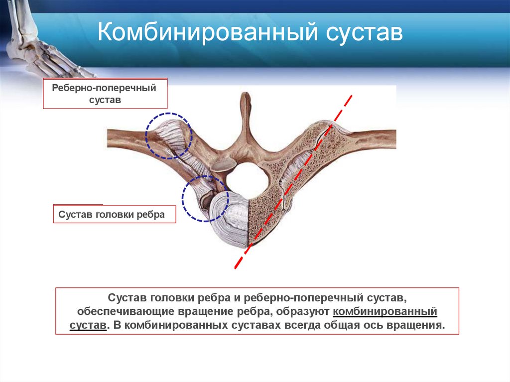 Комбинированный сустав