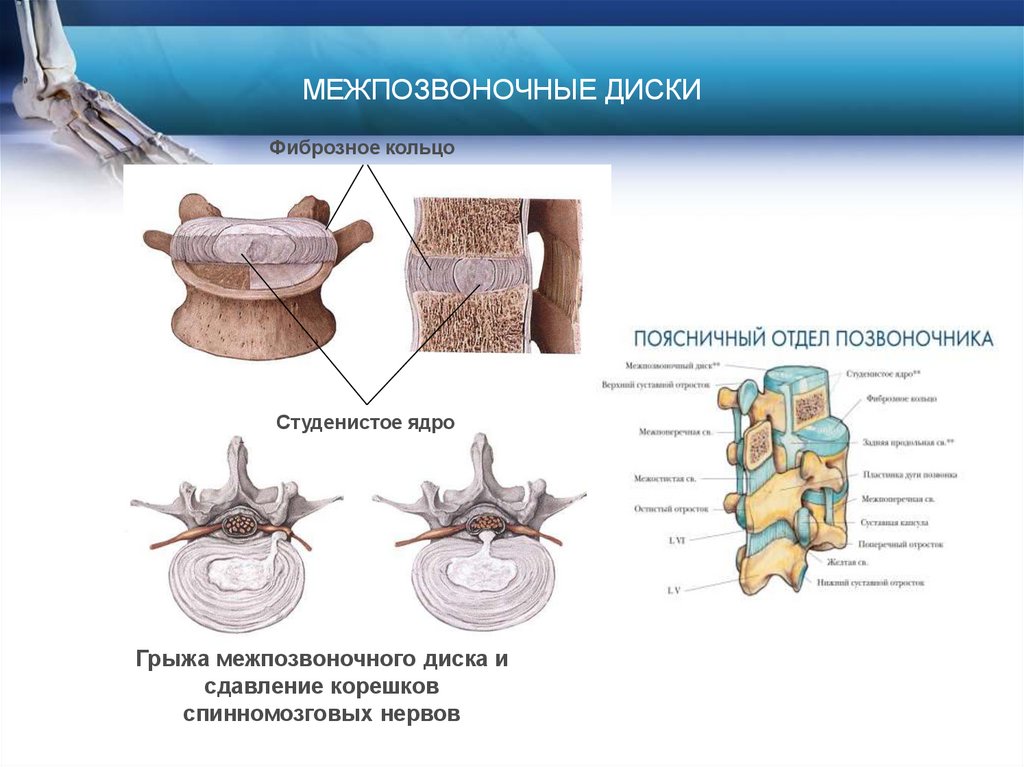 МЕЖПОЗВОНОЧНЫЕ ДИСКИ