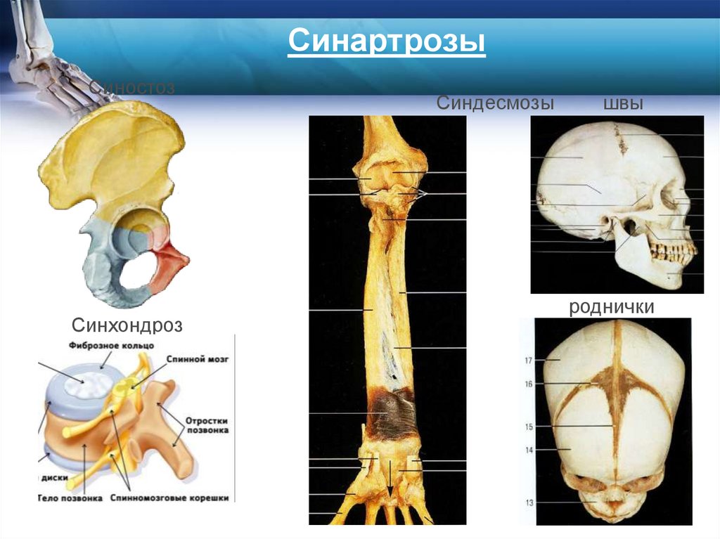 Синартрозы