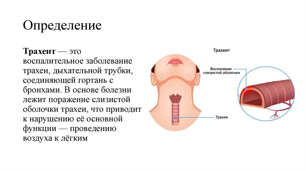 Определение