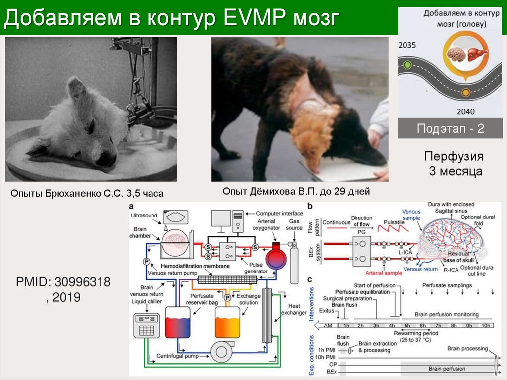 Добавляем в контур EVMP мозг