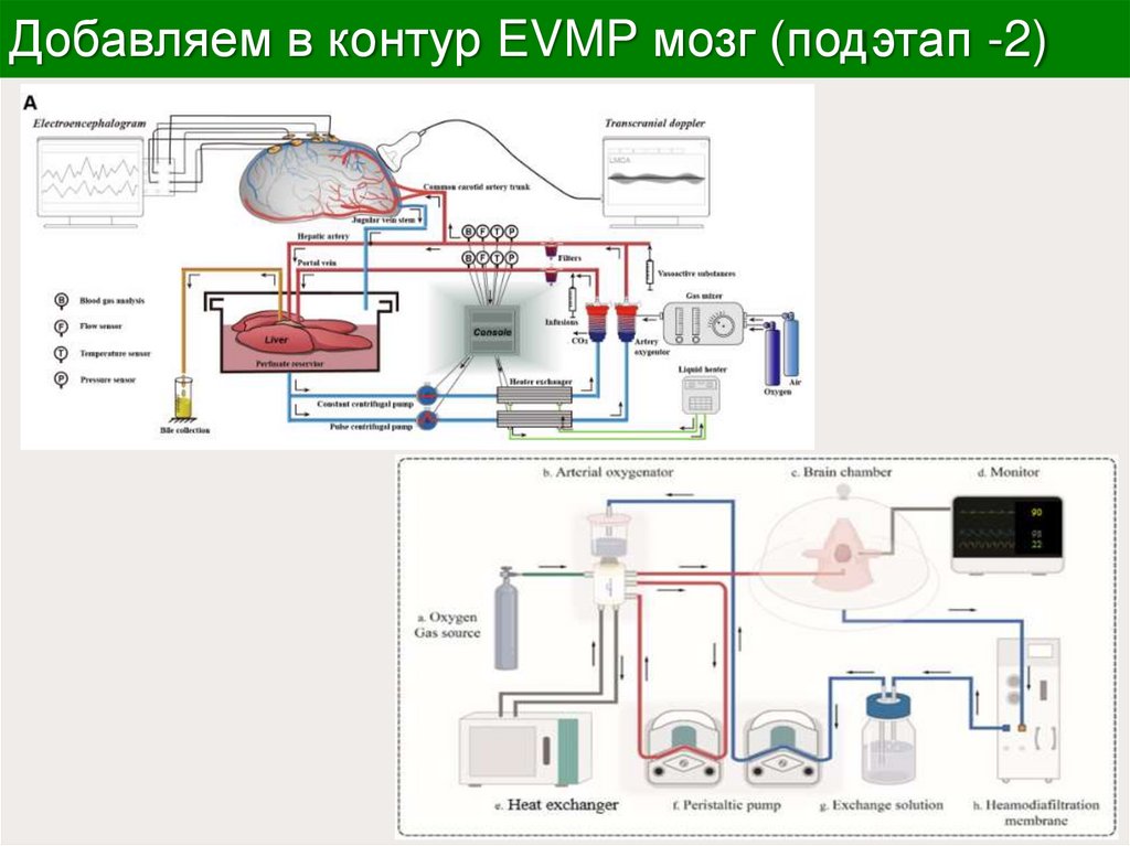 Добавляем в контур EVMP мозг (подэтап -2)