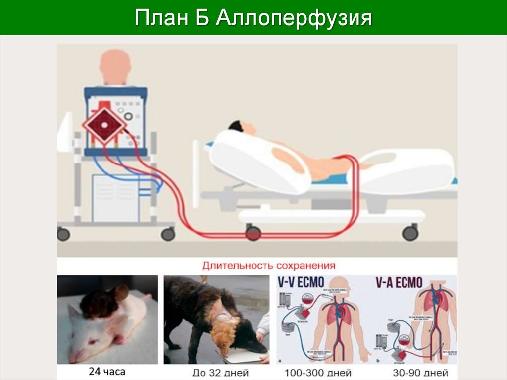 План Б Аллоперфузия