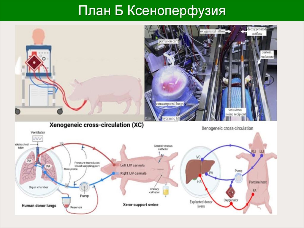 План Б Ксеноперфузия