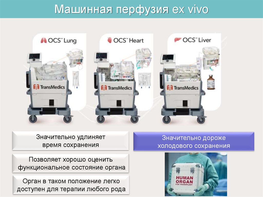 Машинная перфузия ex vivo