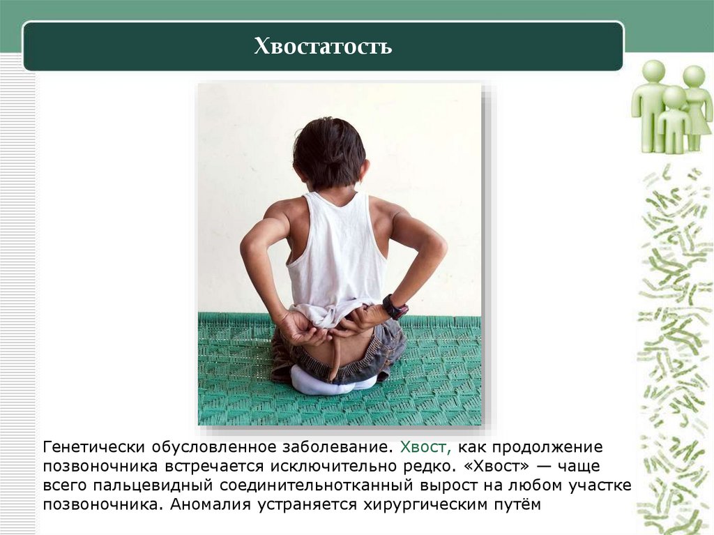 Хвостатость