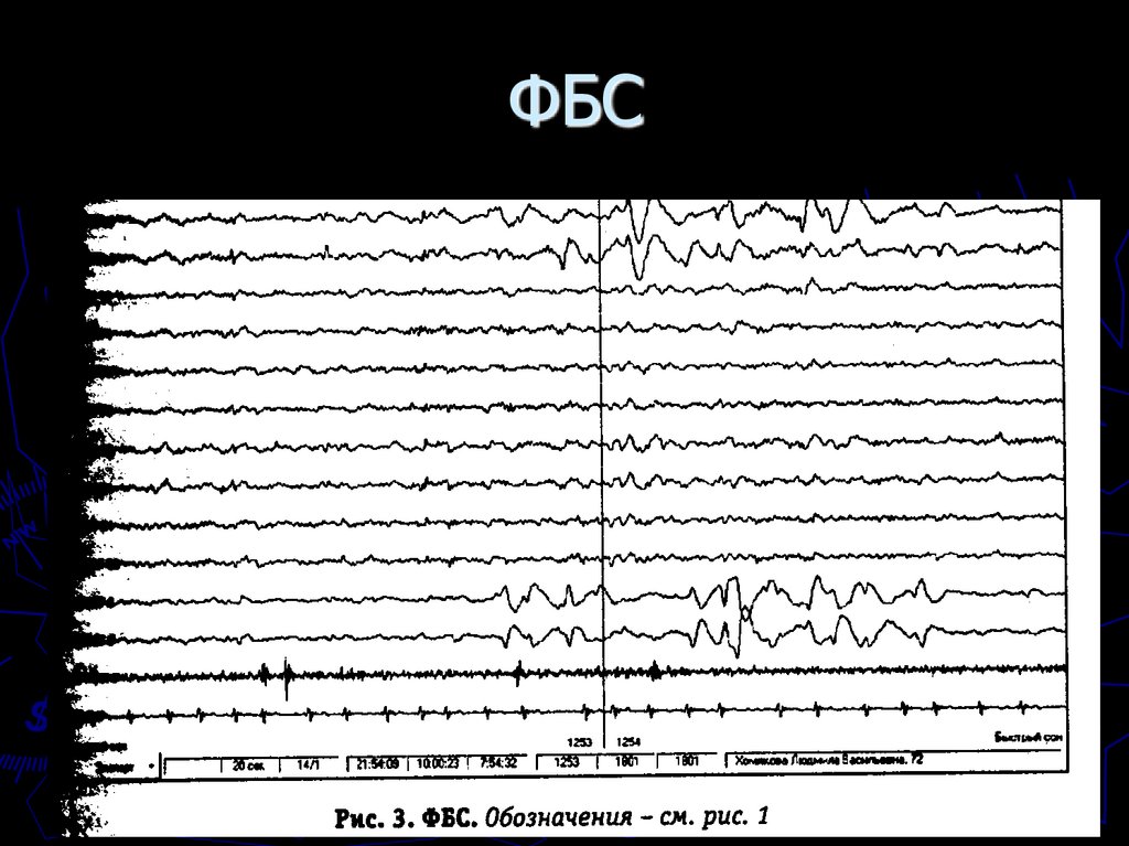 ФБС