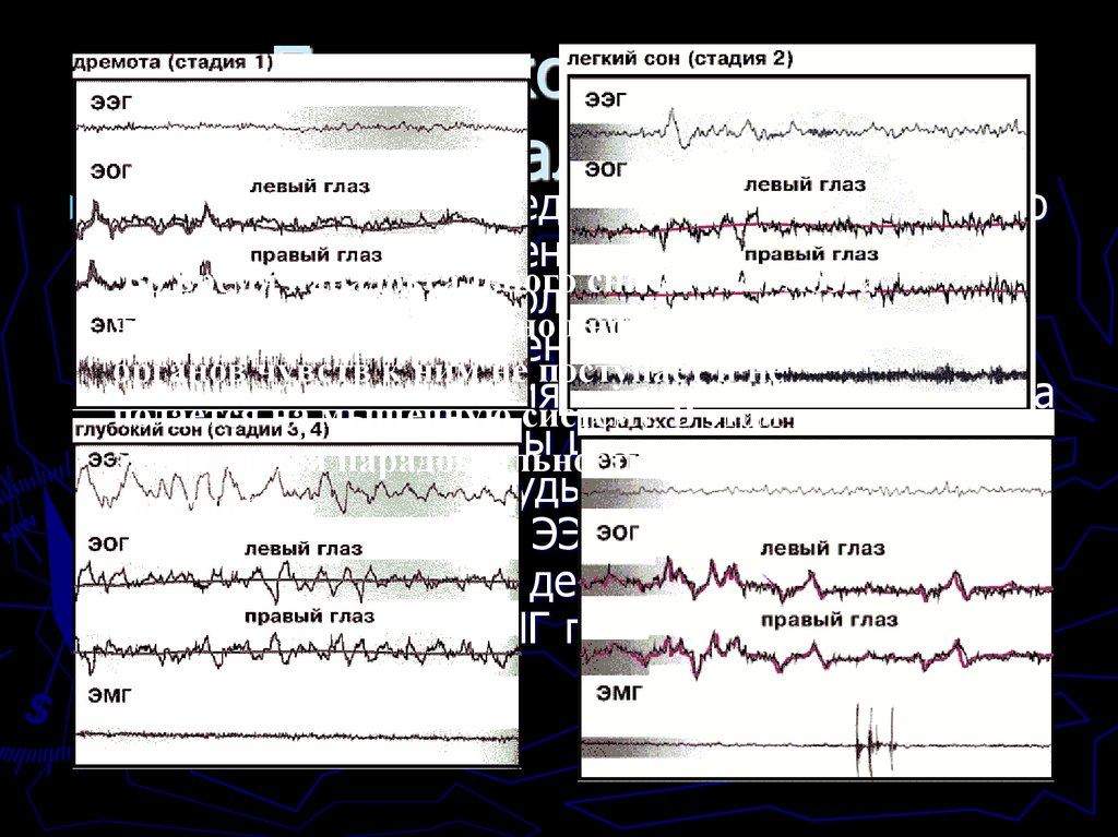 Парадоксальность “парадоксального” сна