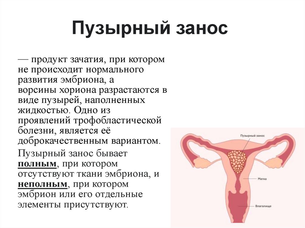 Пузырный занос 